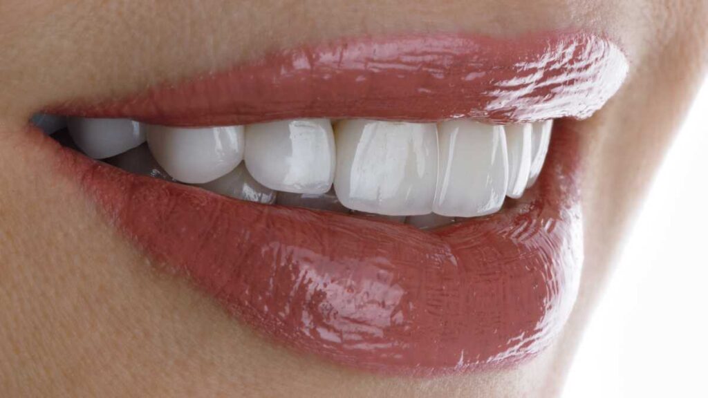 Dentes de Porcelana: Vale a pena colocar